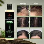 Rosemary Hydrolyzed Keratin Shampoo (Pack of 2) | Repair Damaged Hair & Reduce Breakage