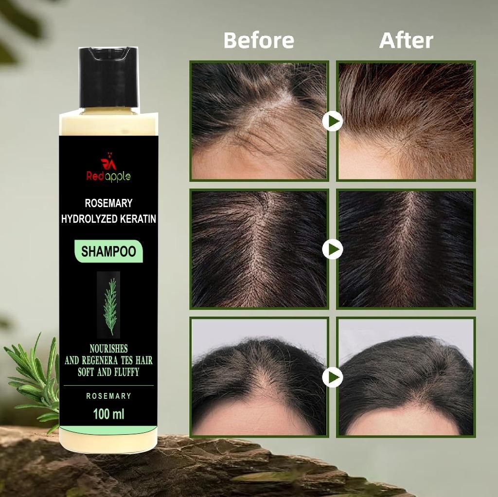 Rosemary Hydrolyzed Keratin Shampoo (Pack of 2) | Repair Damaged Hair & Reduce Breakage